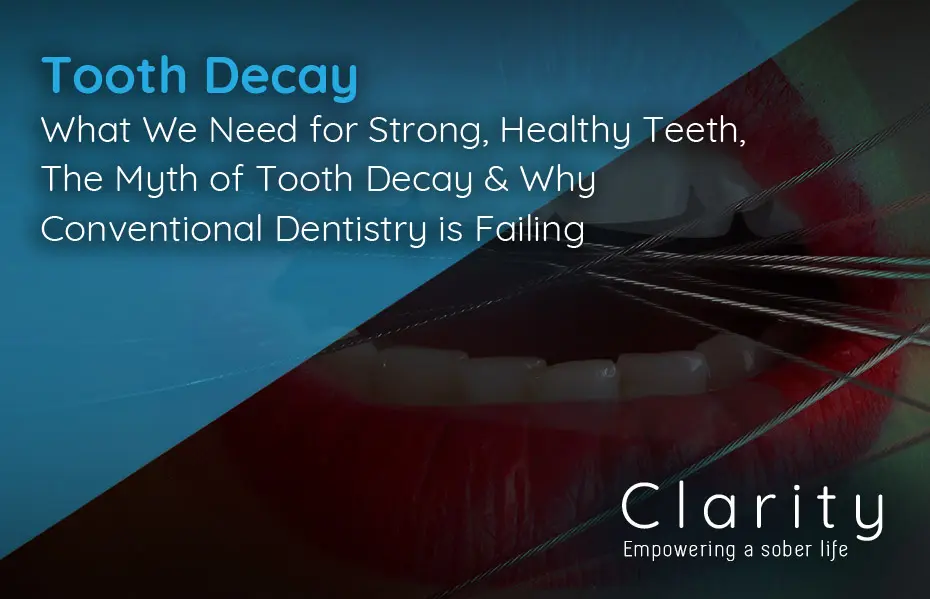 Tooth Decay: What We Need for Strong, Healthy Teeth, The Myth of Tooth Decay & Why Conventional Dentistry is Failing